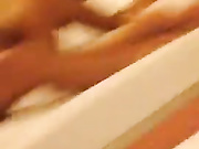 Беркова сосет