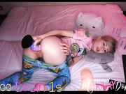 mykinkydope