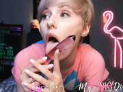 Mykinkydope