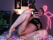 Mykinkydope