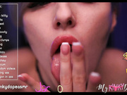 mykinkydope