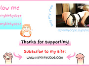 mykinkydope