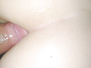 Brosexsis anal