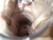 larara