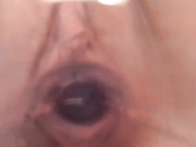 larara