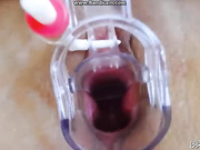 Бейба гинекологический осмотр 2