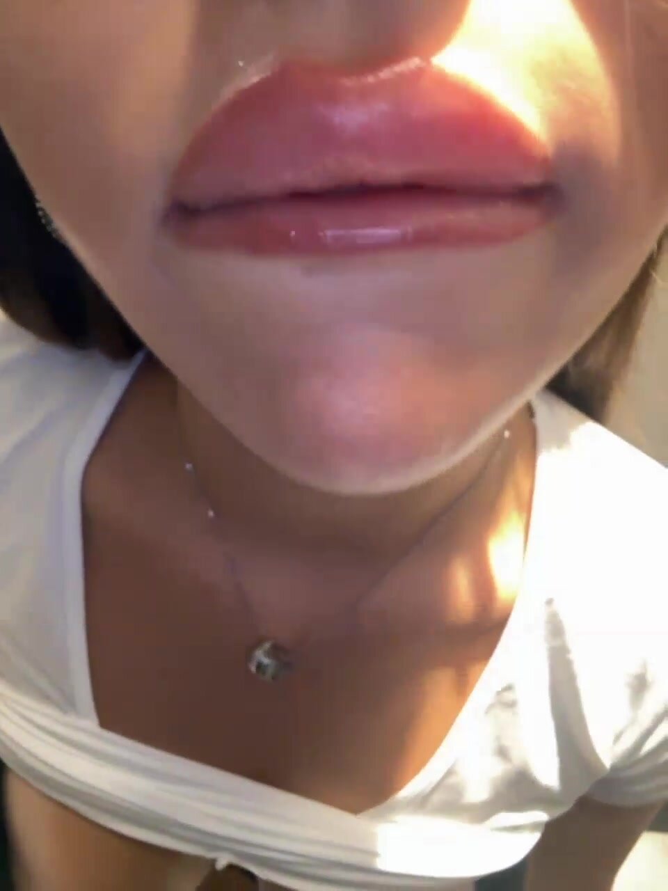 Syka001