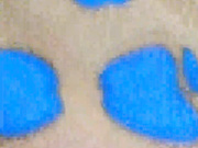 albinainsti