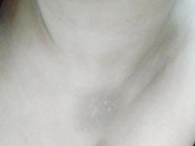 albinainsti