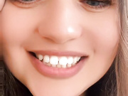 SOSKA